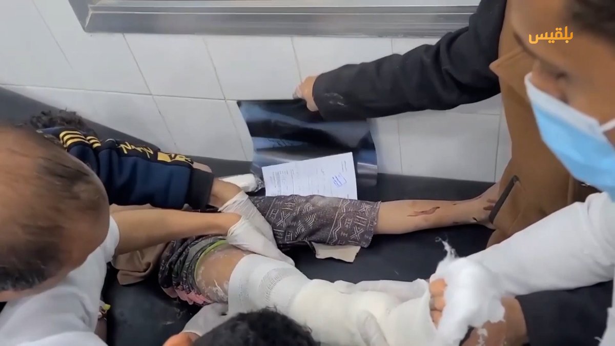 Several civilians were killed and injured as a result of the Houthi shelling on Marib